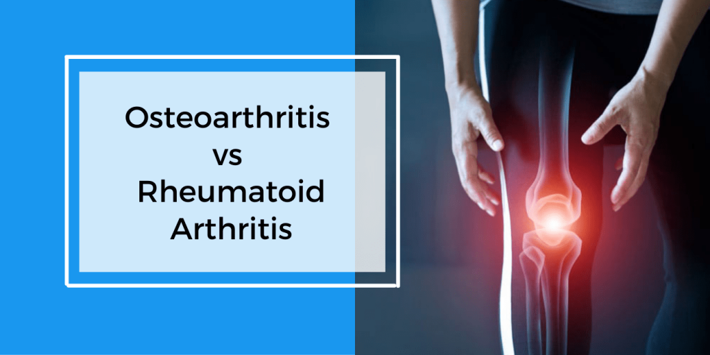 Osteoarthritis vs Rheumatoid Arthritis